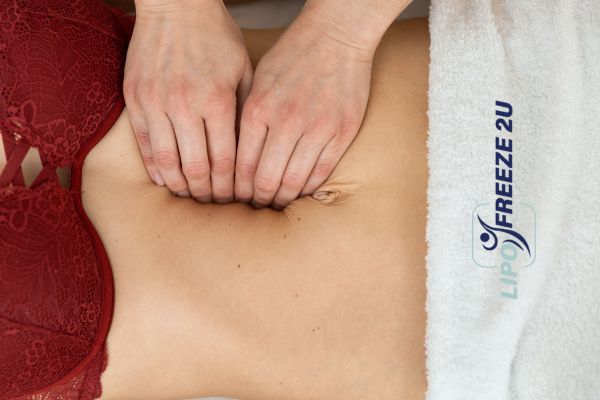 diastasis recti treatment Irvine