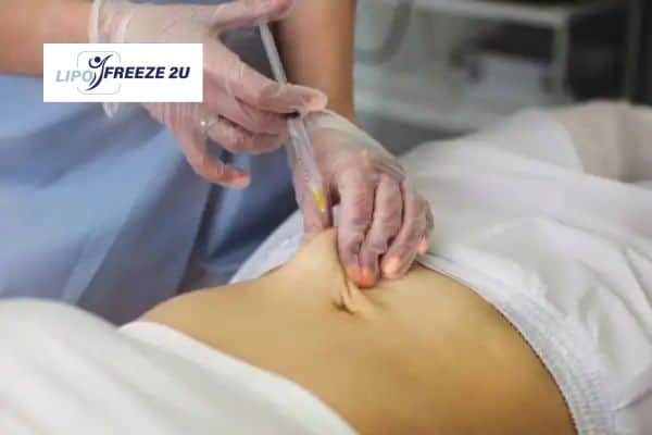 How Does Aqualyx Fat Dissolving Injection Work to Break Down Fat Irvine?