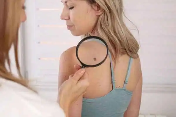 A side-by-side infographic comparing CryoPen cryotherapy with electrosurgery, highlighting differences in invasiveness, pain, and recovery Irvine