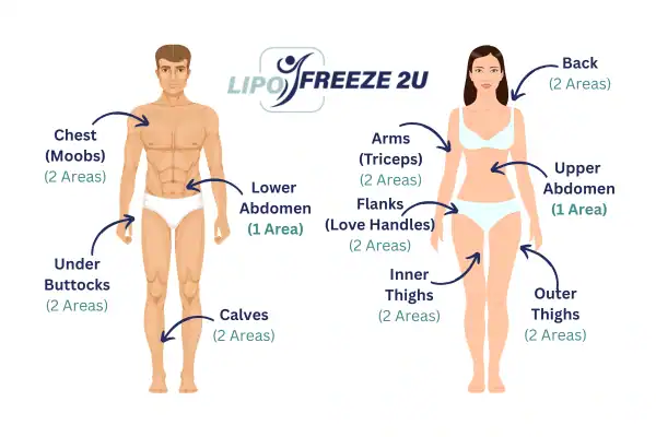 Areas you can have fat freezing treatment Irvine