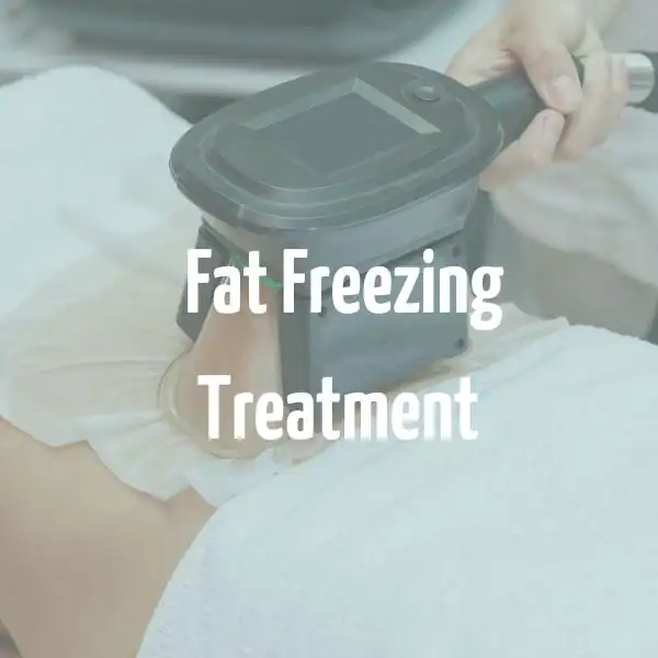 fat freezing treatment Irvine