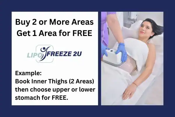 fat freezing prices Irvine