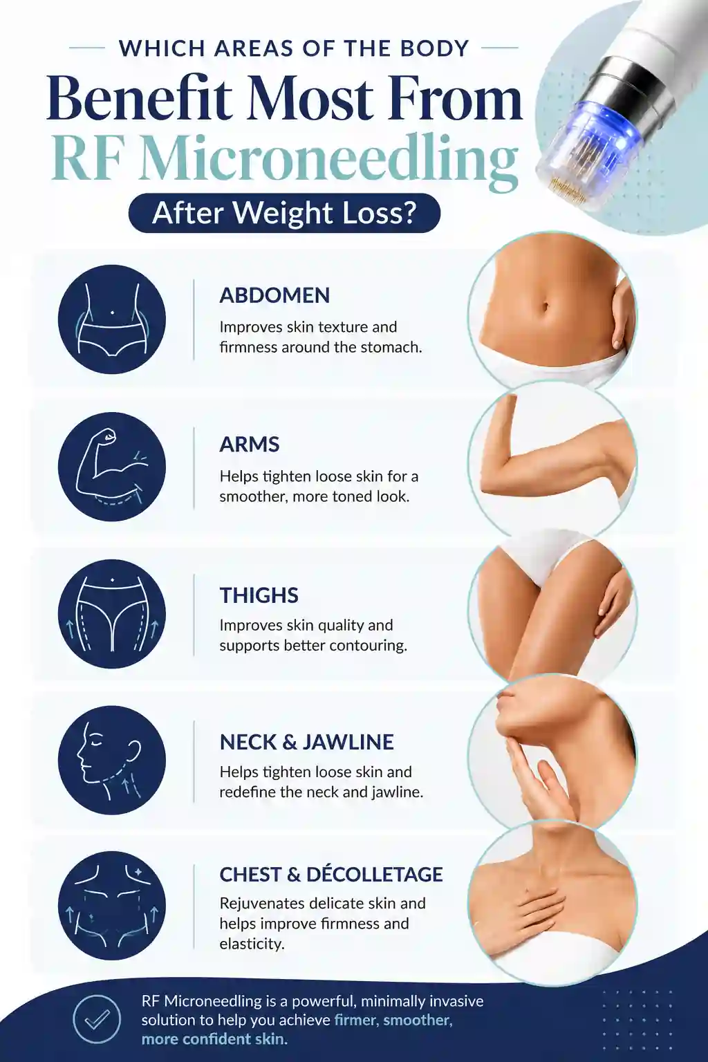Which Areas of the Body Benefit Most From RF Microneedling After Weight Loss Irvine